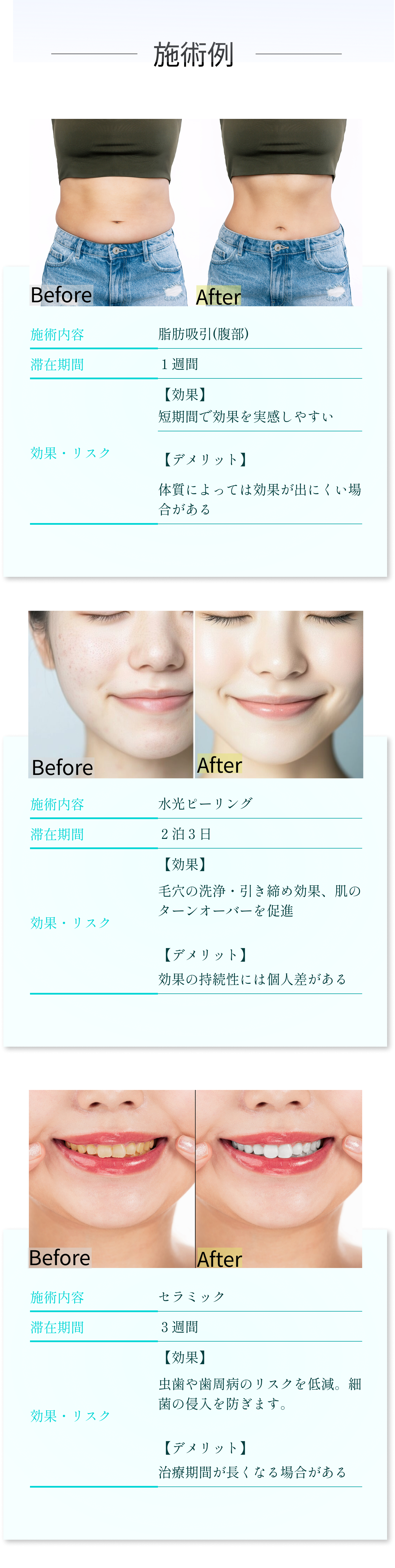 術前後の写真で変化を視覚的に示し、美容医療の魅力と注意点を説明
